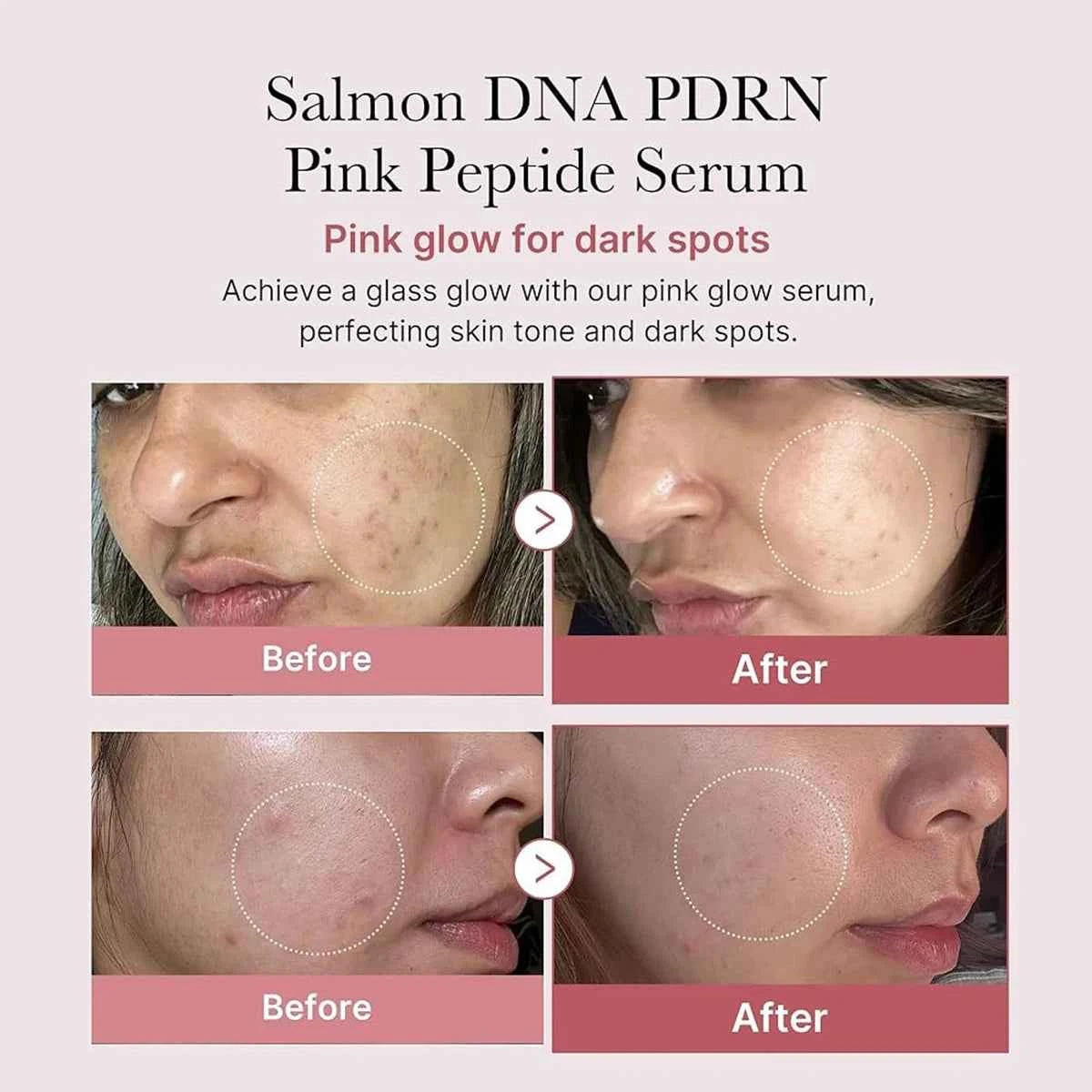 Medicube Salmon DNA PDRN Pink Peptide Serum — Lifting & Repair Repairing K‑Beauty Serum