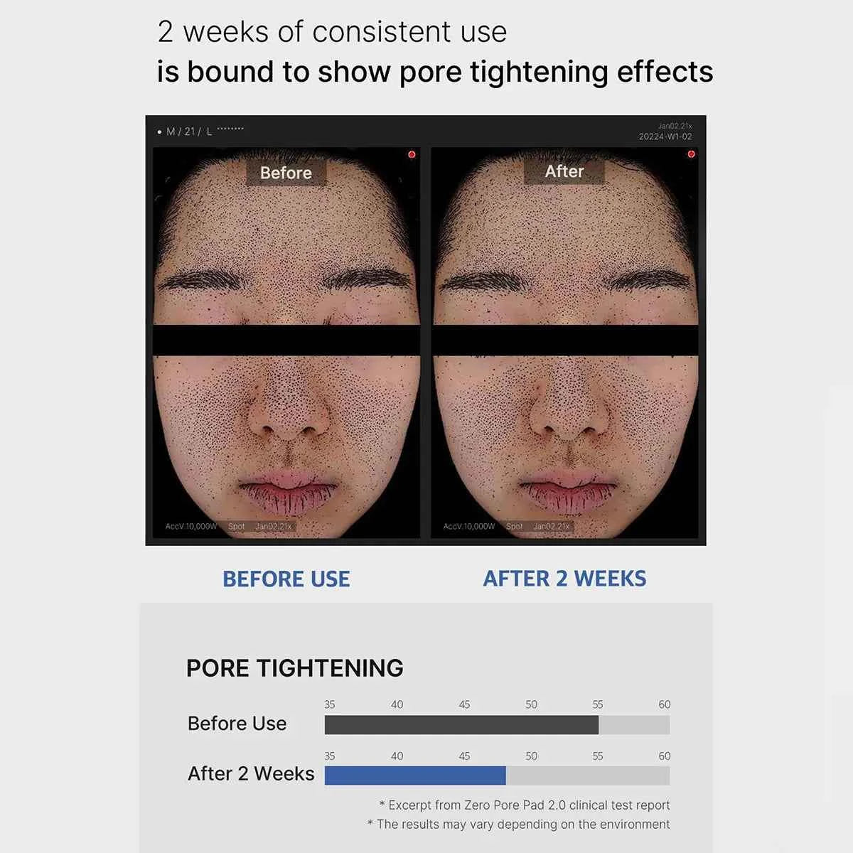 Medicube Zero Pore Pad 2.0 — Pore Tightening & Hydrating K‑Beauty Skincare